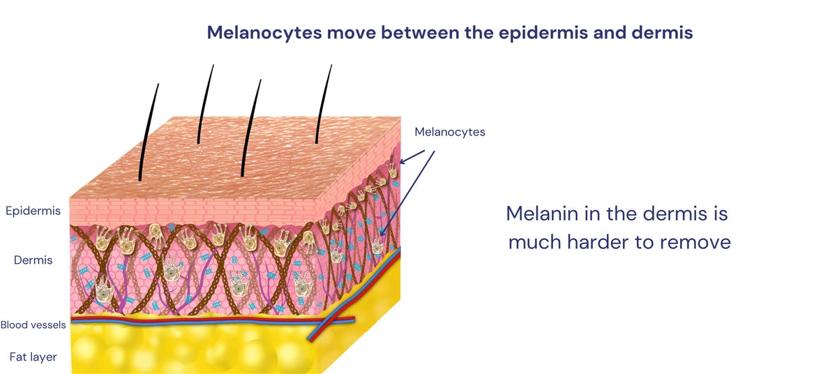 Title: The Epidermis and Dermis: The Two Layers of the Skin