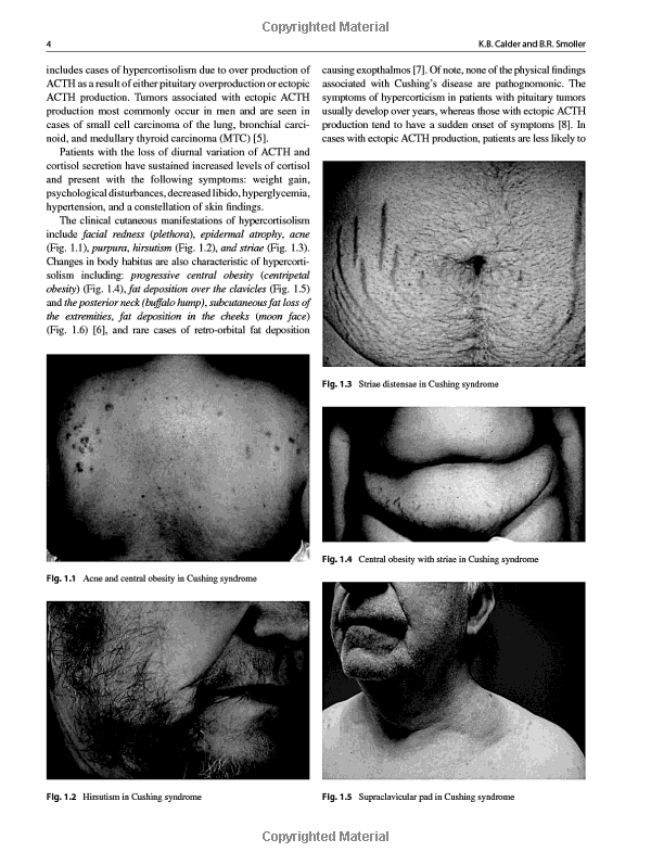 Title: The Dermis and Epidermis: The Two Layers of Skin