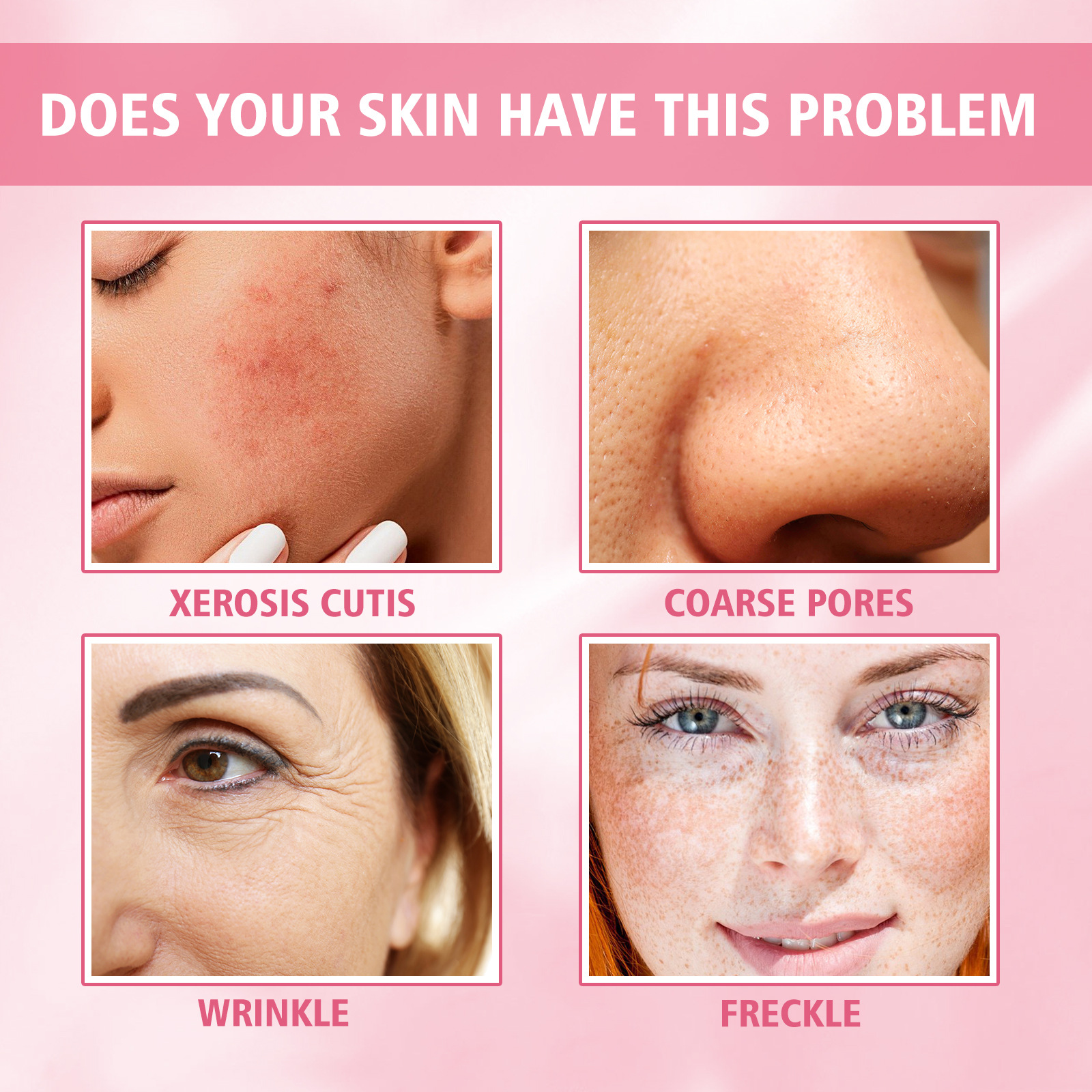 Title: The Causes of True Skin Spots