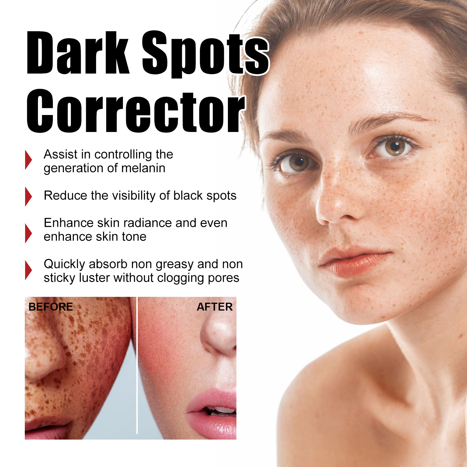 Title: The Difference between True-Skin Spots and Yellow-Skin Spots