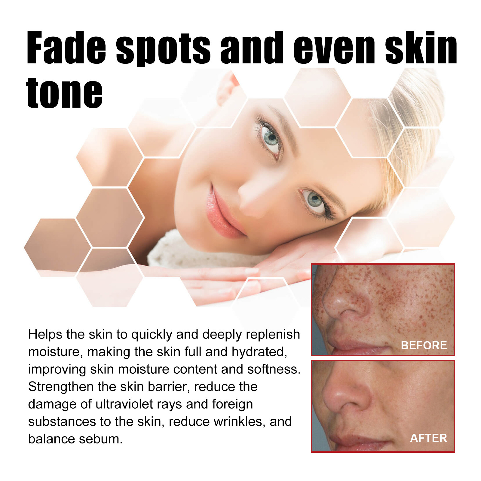 Title: The Difference between True Skin Spots and Yellowish-Brown Spots